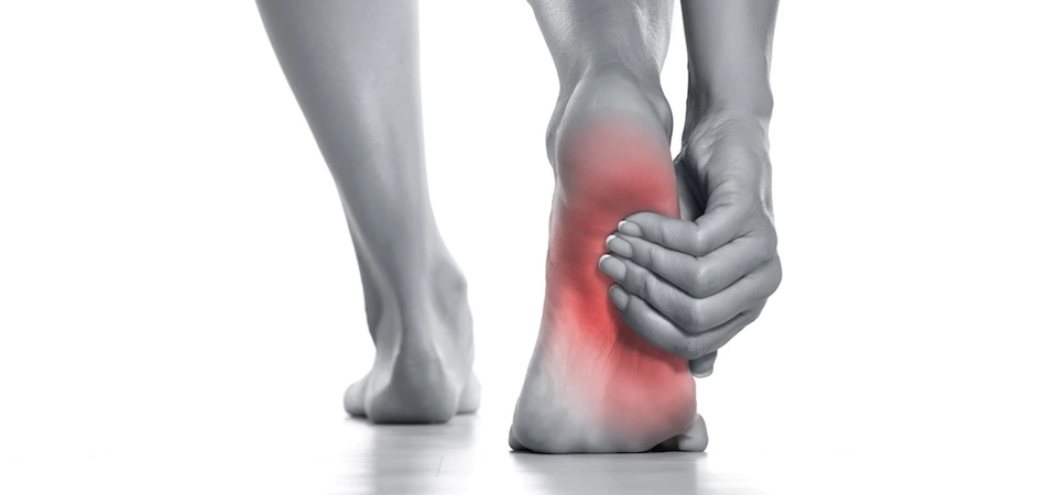 Neural Therapy for Plantar Fasciitis (Heel Pain) Plantar fasciitis is a painful inflammation of the plantar fascia, also known as the tendon plate, extending from the heel to the sole of the foot.