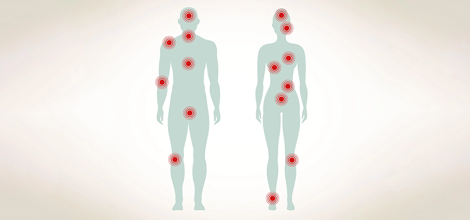 Fibromyalgia Syndrome (FMS): The Role of Neural Therapy in Reducing Pain and Improving Quality of Life - Fibromyalgia syndrome (FMS) is a complex and chronic pain condition characterized by widespread musculoskeletal pain, fatigue, sleep disorders, and cognitive problems.