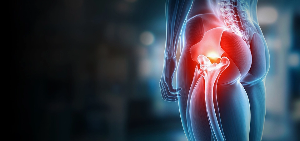 Hip Pain: A Holistic Treatment Approach Addressing Local and Referred Internal Organ Causes