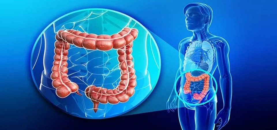 Intestinal Fungus (Candida Albicans) - Things to Watch For with Candida Candida Can Be Permanently Treated with the Regulation Neural Therapy Approach!