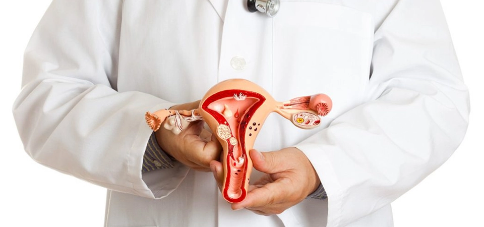 Neural Therapy and Complementary Medicine Applications in Endometriosis - The cause of endometriosis is still not fully known. For this reason, the modern medicine approach is often symptom-focused.