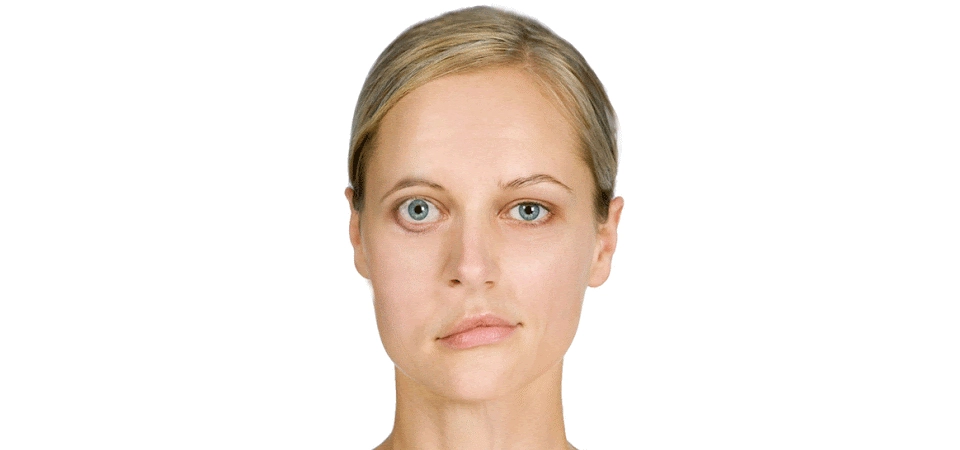 Neural Therapy in Peripheral Facial Paralysis Peripheral facial paralysis, which develops as a result of peripheral involvement of the facial nerve (cranial nerve VII), is mostly benign in course.